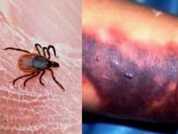 یک قربانی؛ بر اثر تب کریمه کنگو در صالحآباد خراسان رضوی یک قربانی؛ بر اثر تب کریمه کنگو در صالحآباد خراسان رضوی