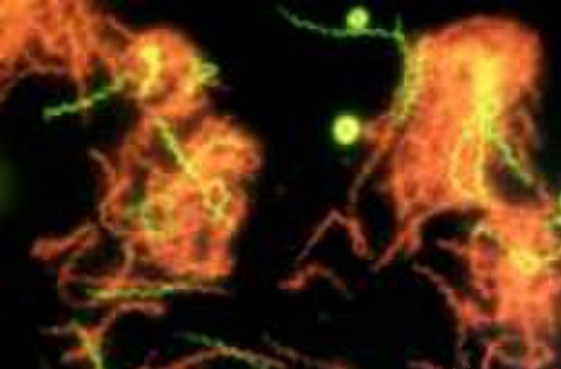 اکستروموفیل ها، مقاومترین موجودات روی زمین