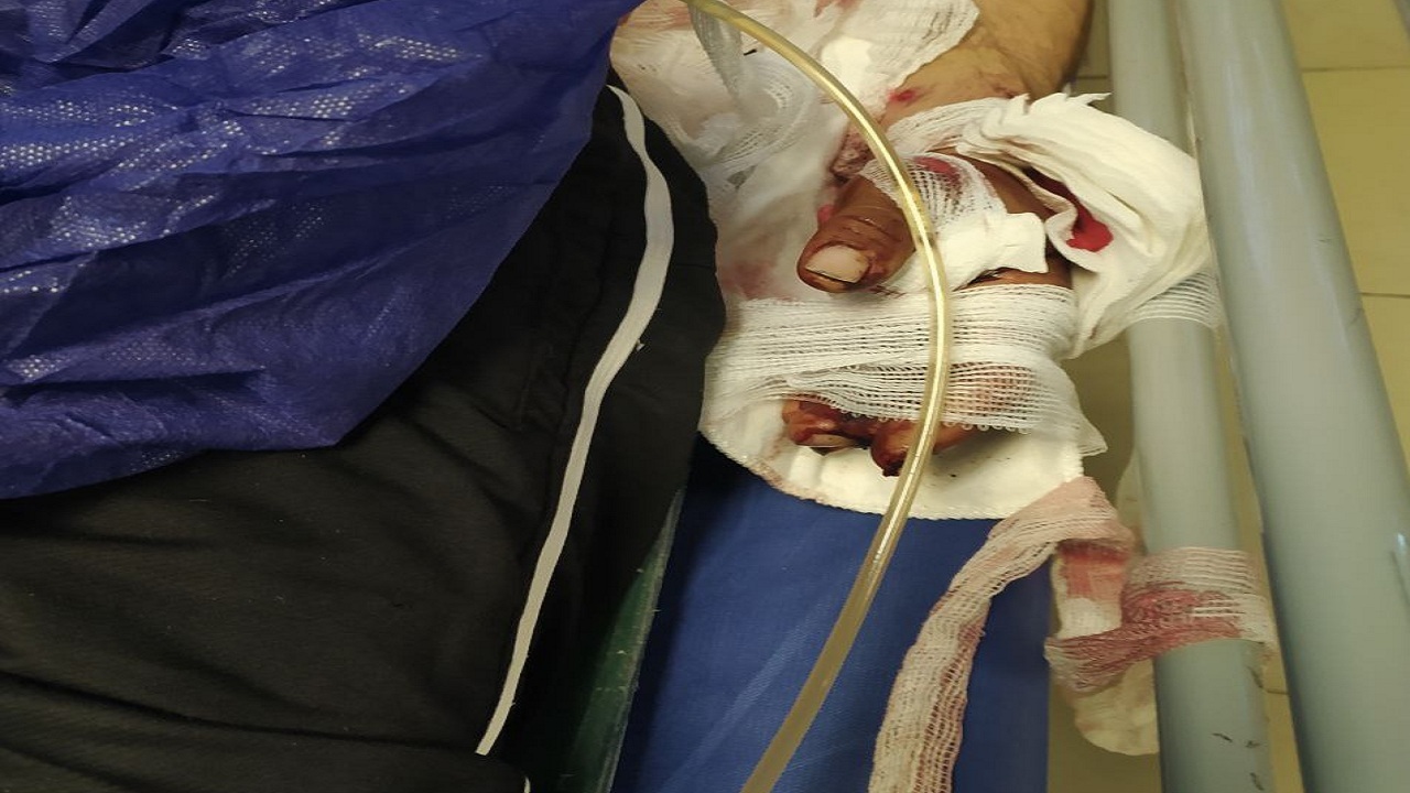 حمله خرس به چوپان در هوراند